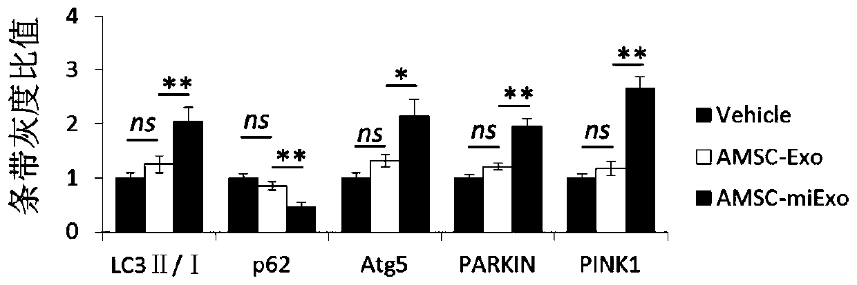 Preparation method and application of adipose-derived mesenchymal stem cell exosome