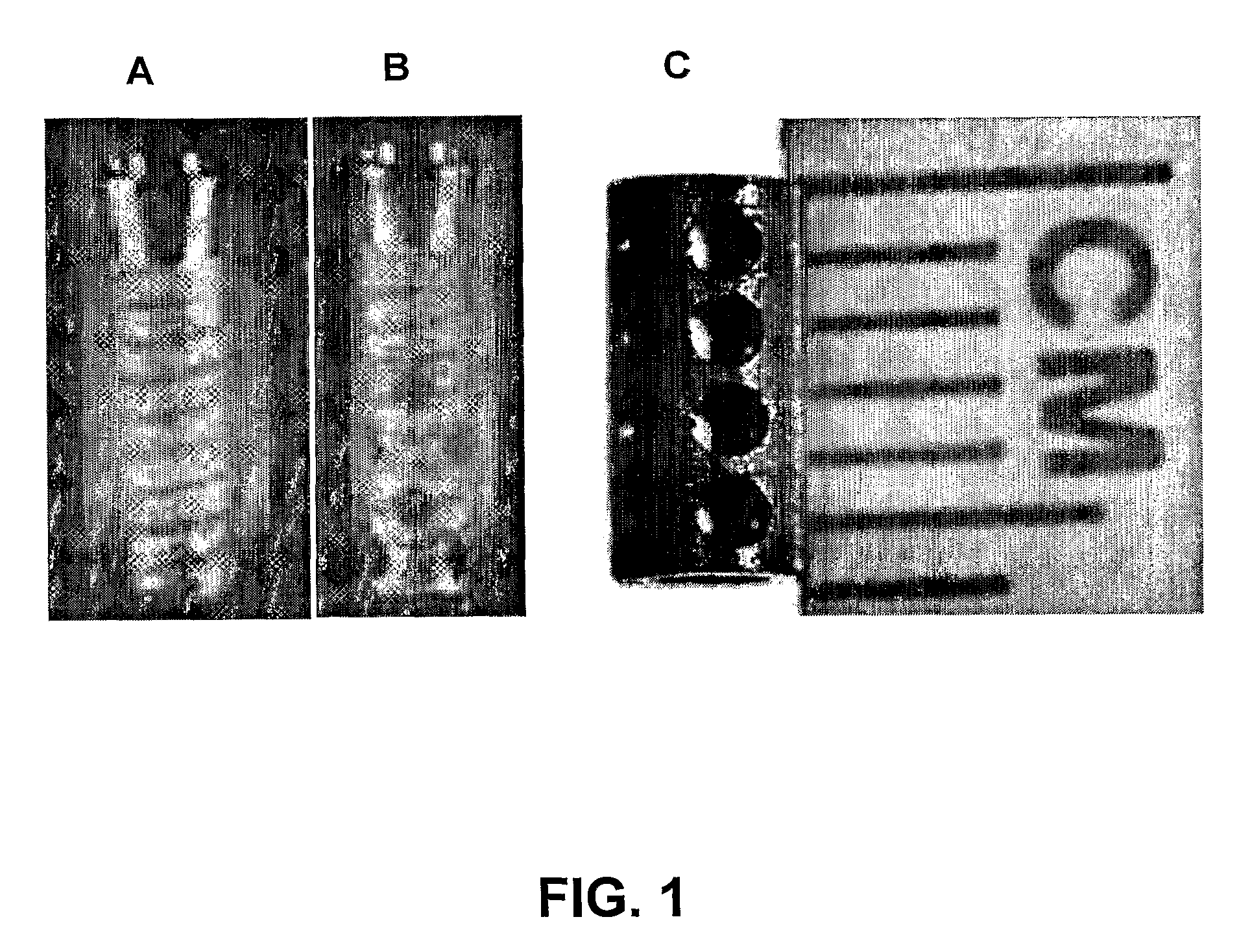 Hollow and porous orthopaedic or dental implant that delivers a biological agent