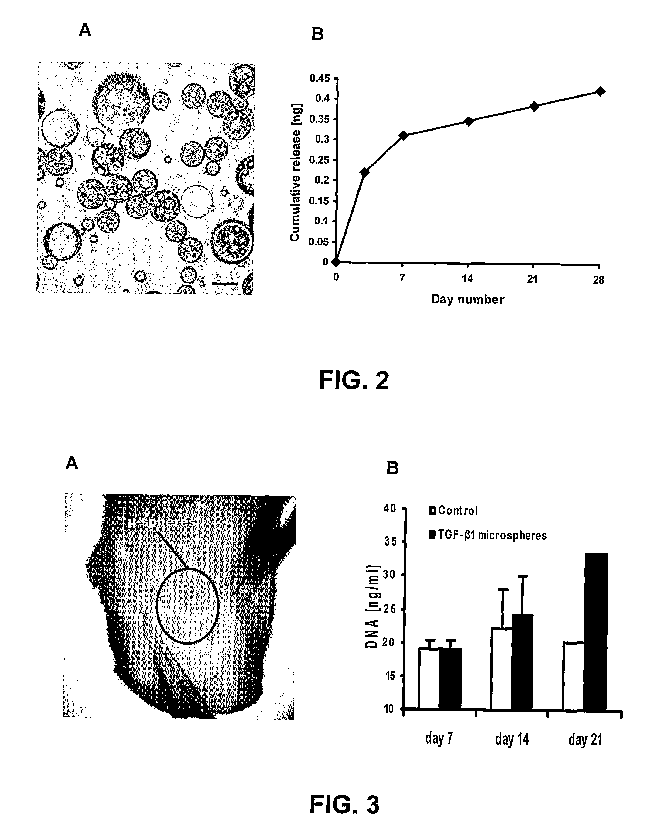 Hollow and porous orthopaedic or dental implant that delivers a biological agent