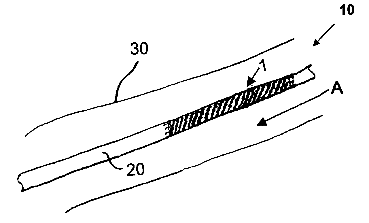 Stent and method for manufacturing the stent