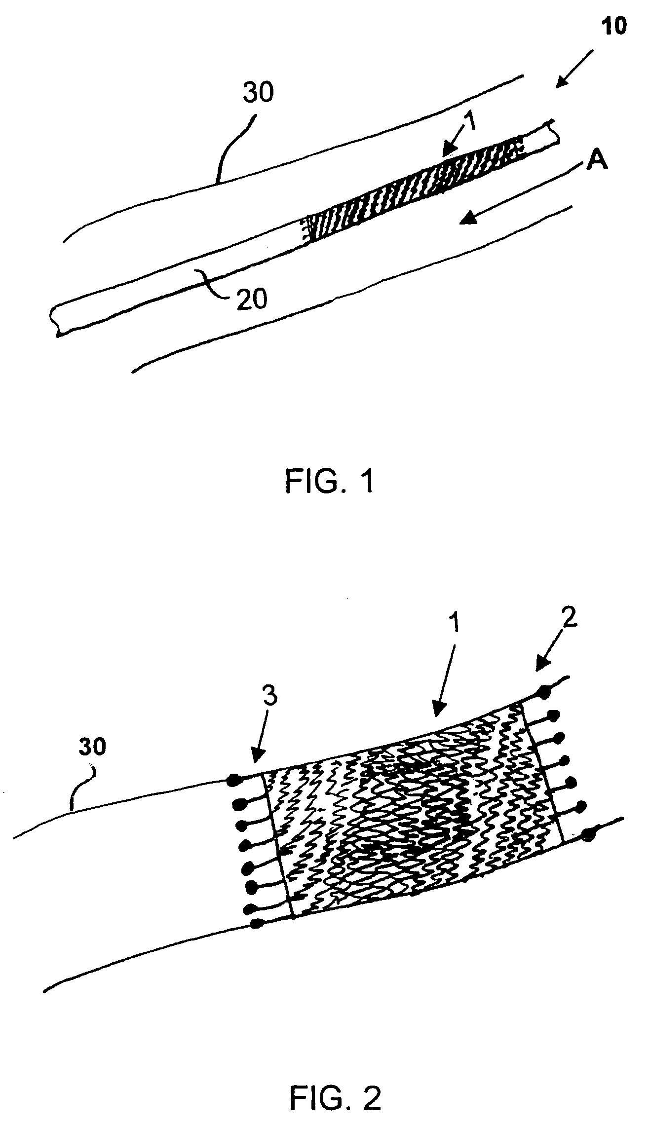 Stent and method for manufacturing the stent