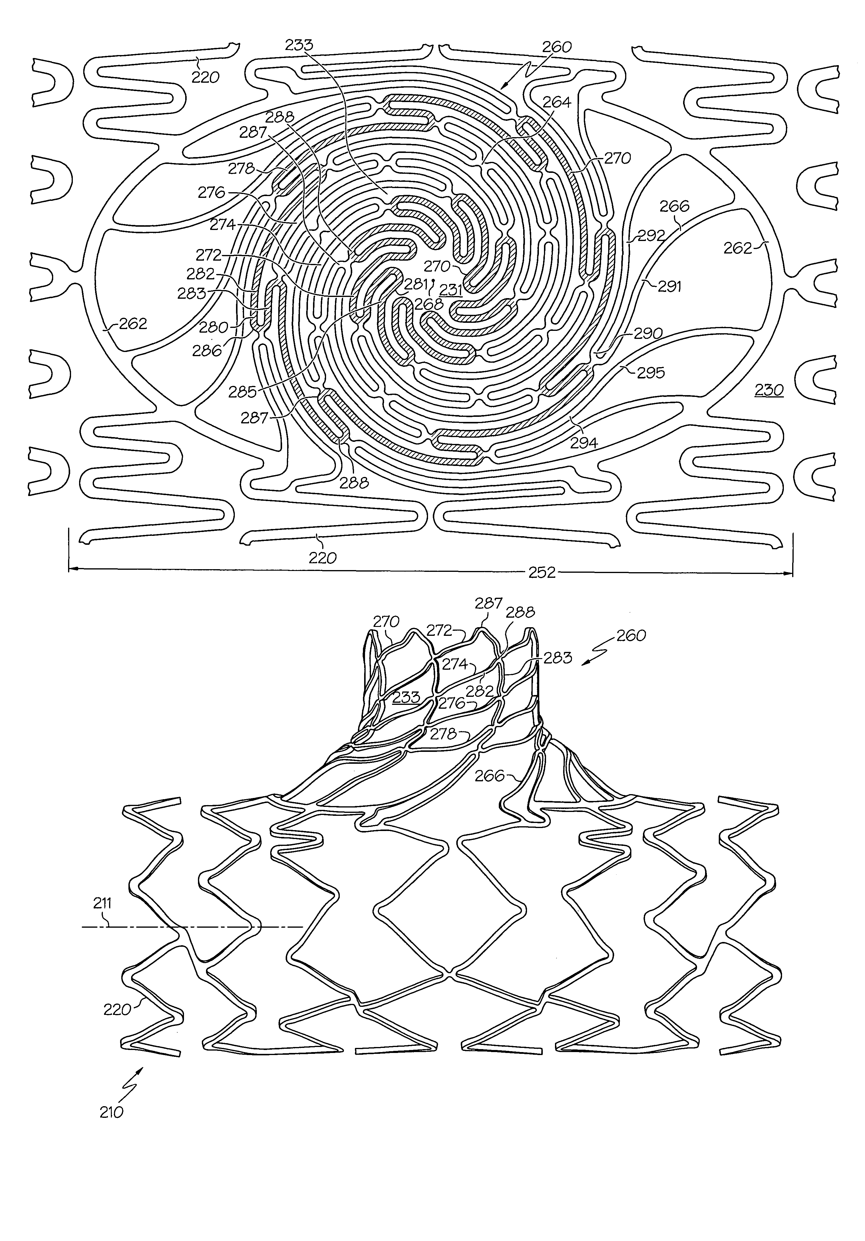 Stent with spiral side-branch