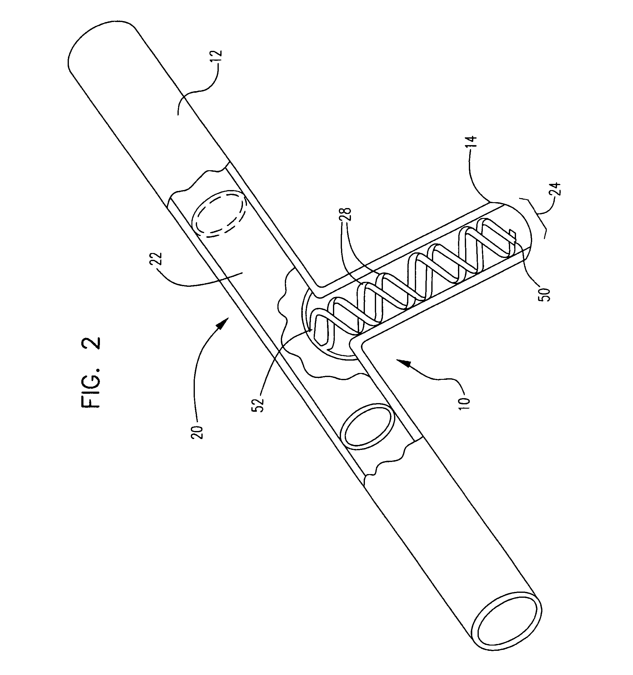 Stent with spiral side-branch