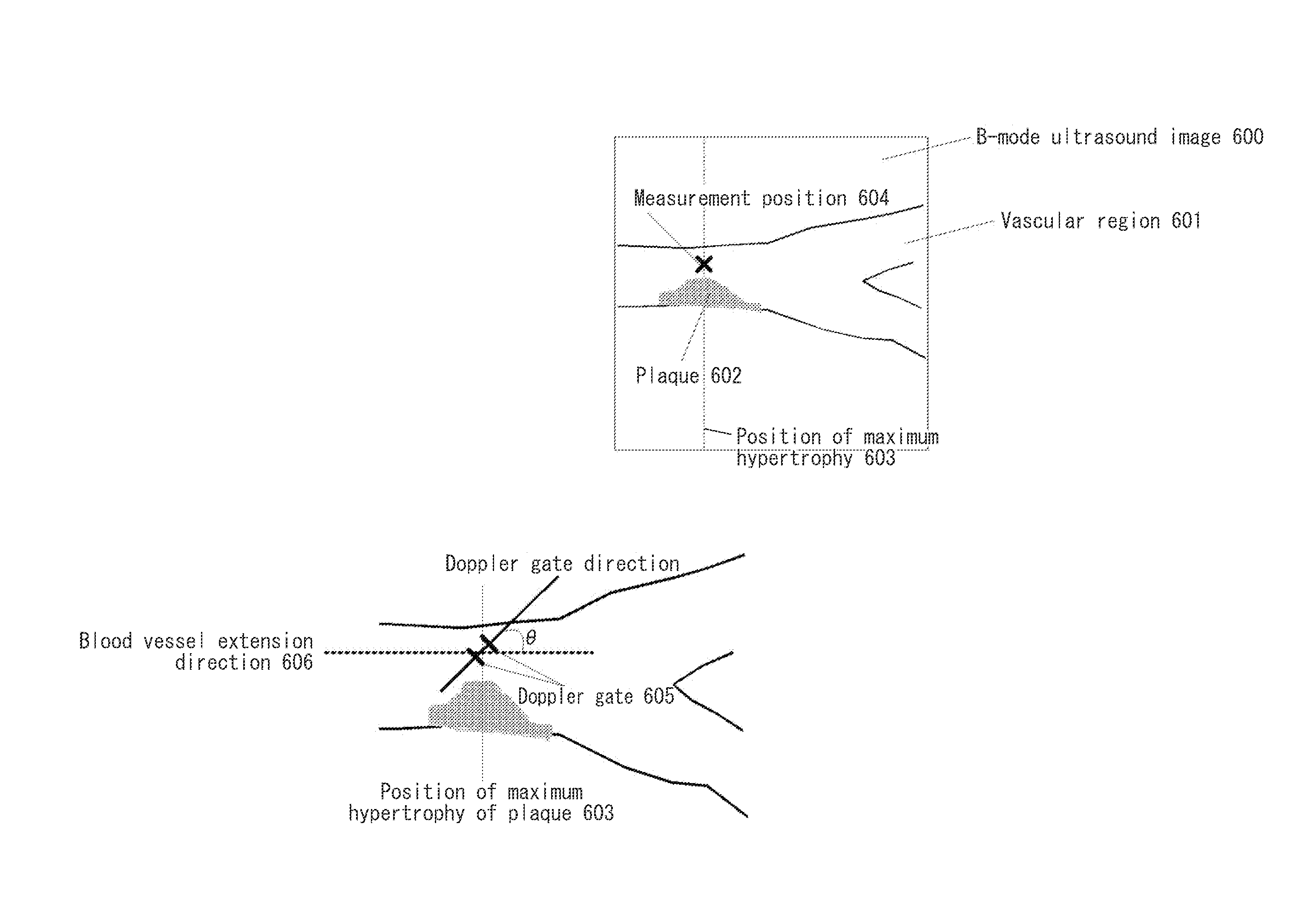 Ultrasound diagnostic apparatus and method for controlling the same