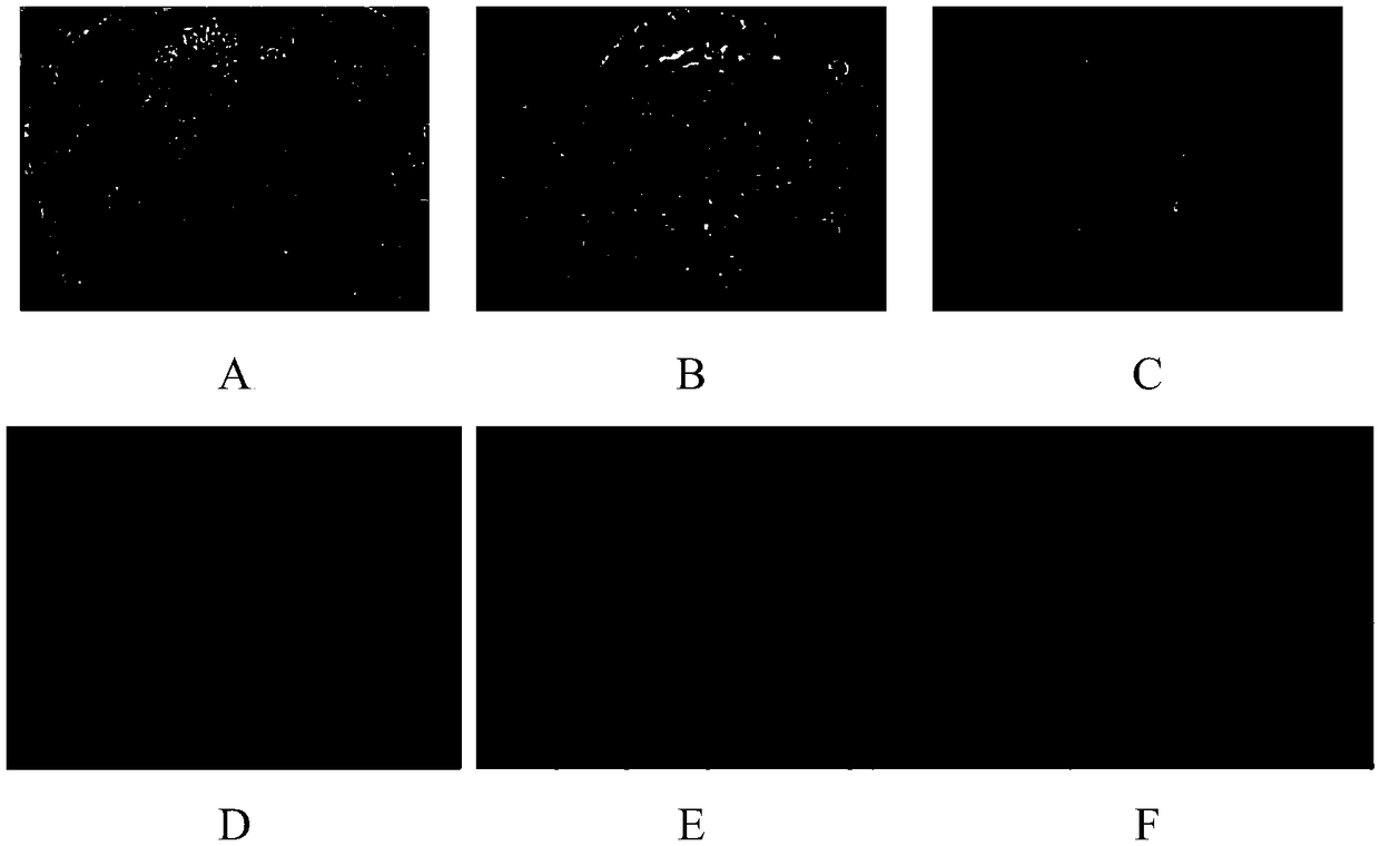 Method for inducing production of chondroblast from umbilical cord mesenchymal stem cells