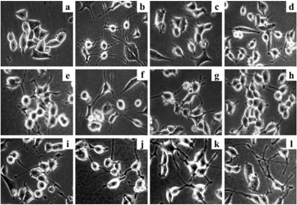 Preparation and anti-Alzheimer's disease uses of Ilex kudingcha C.J.Tseng leaf extract