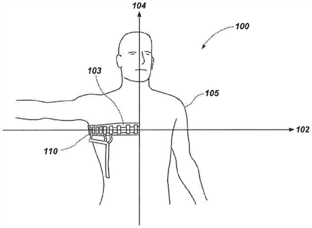 Systems and methods to determine patient's responsiveness to alveolar recruitment maneuver