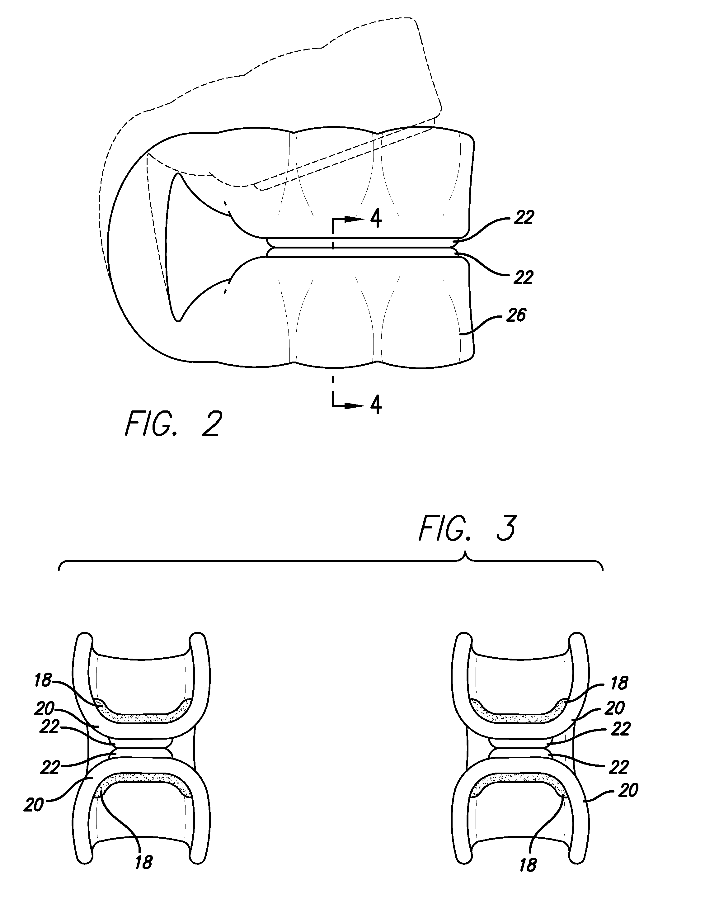 Dental appliance and methods of using the same