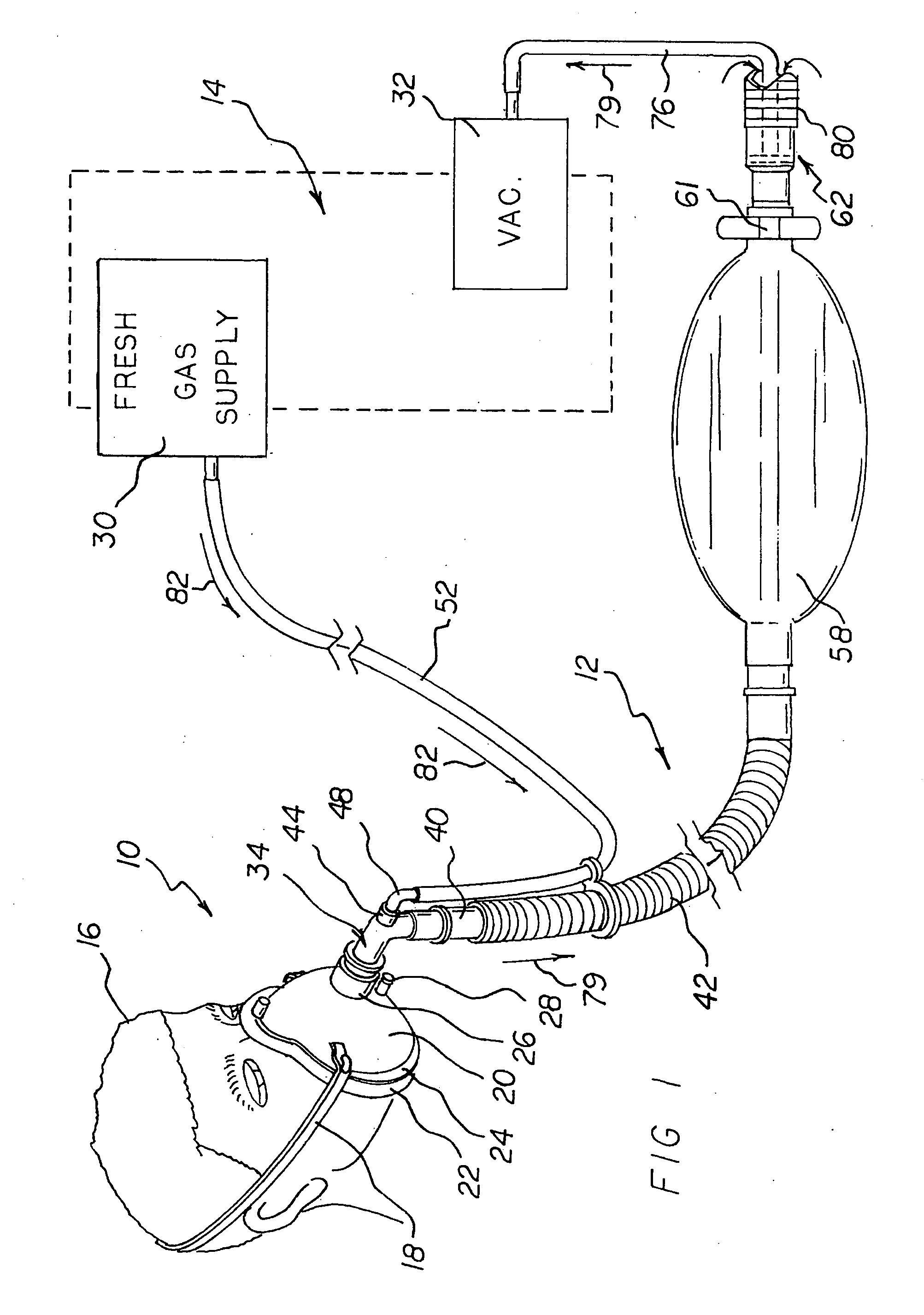 Respiratory face mask and breathing circuit assembly