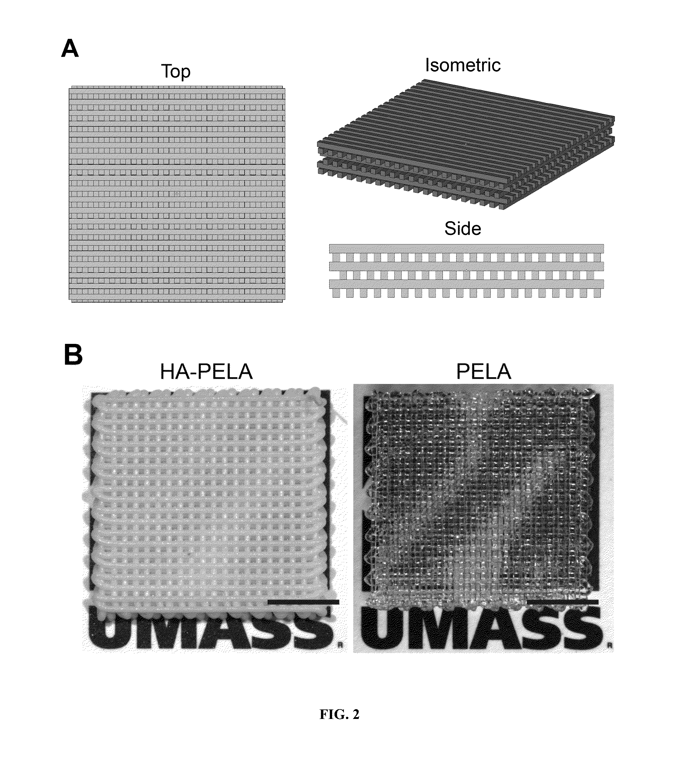 Elastomeric and degradable polymer scaffolds and high-mineral content polymer composites, and in vivo applications thereof