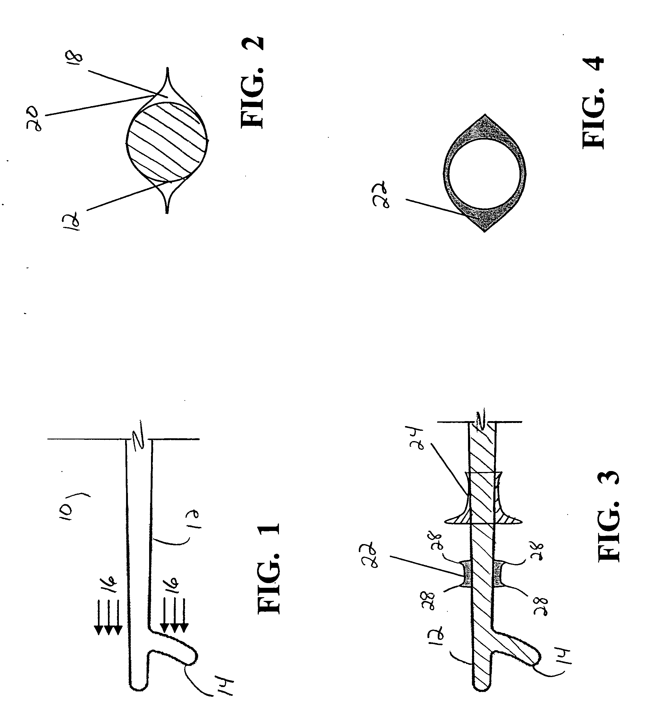 Surgical apparatus