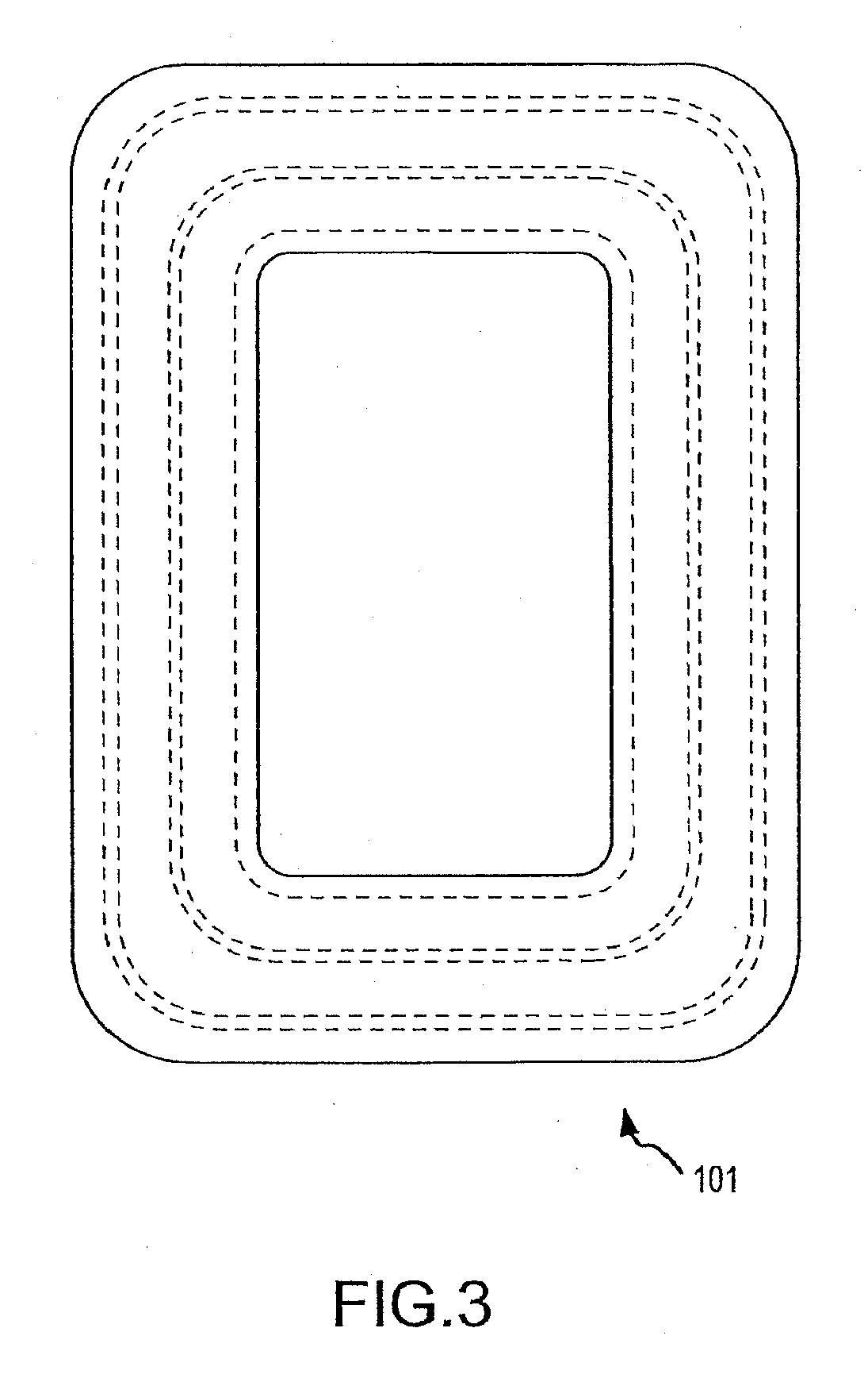 Container Having A Rim Or Other Feature Encapsulated By Or Formed From Injection-Molded Material