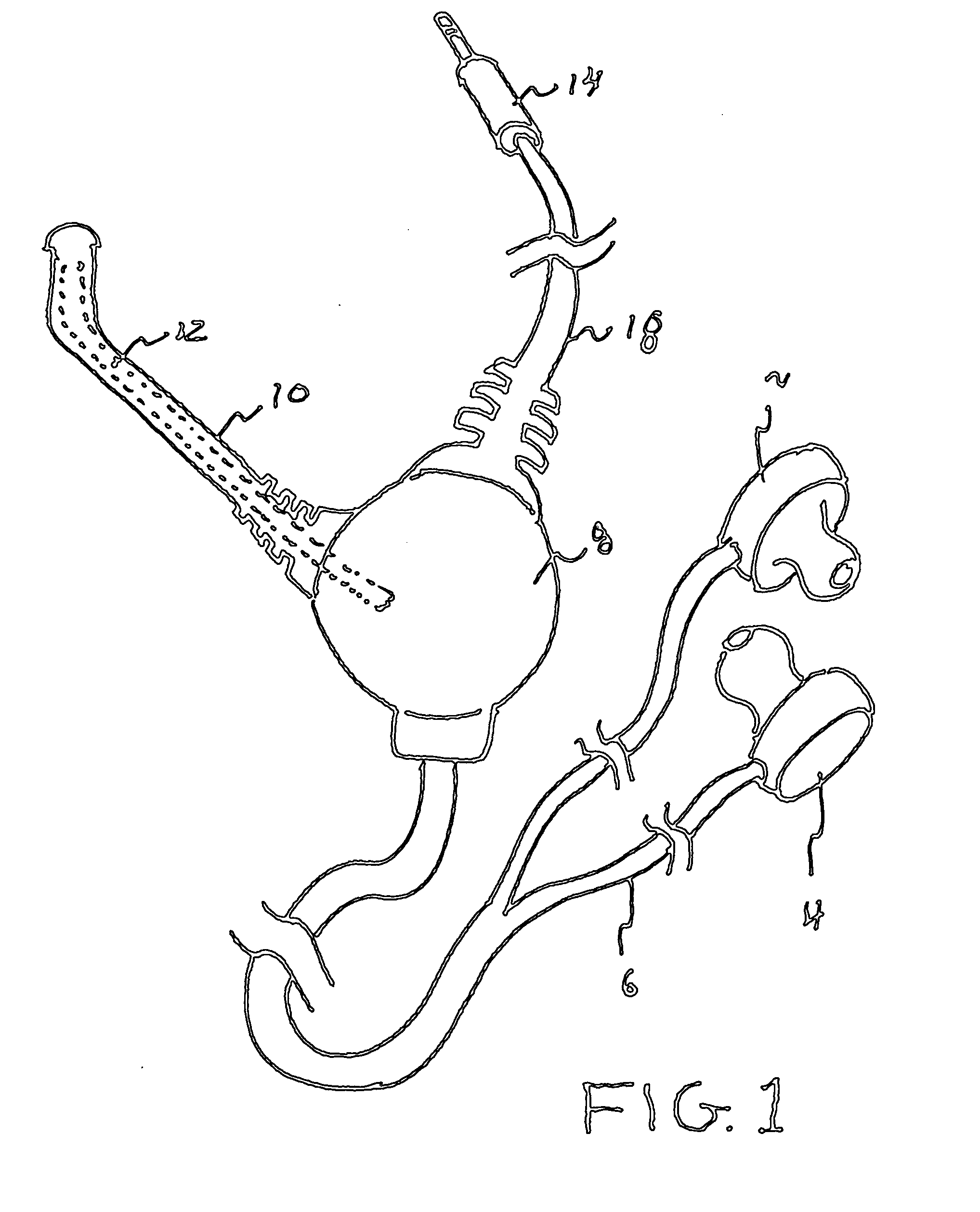 Earbud cable management device