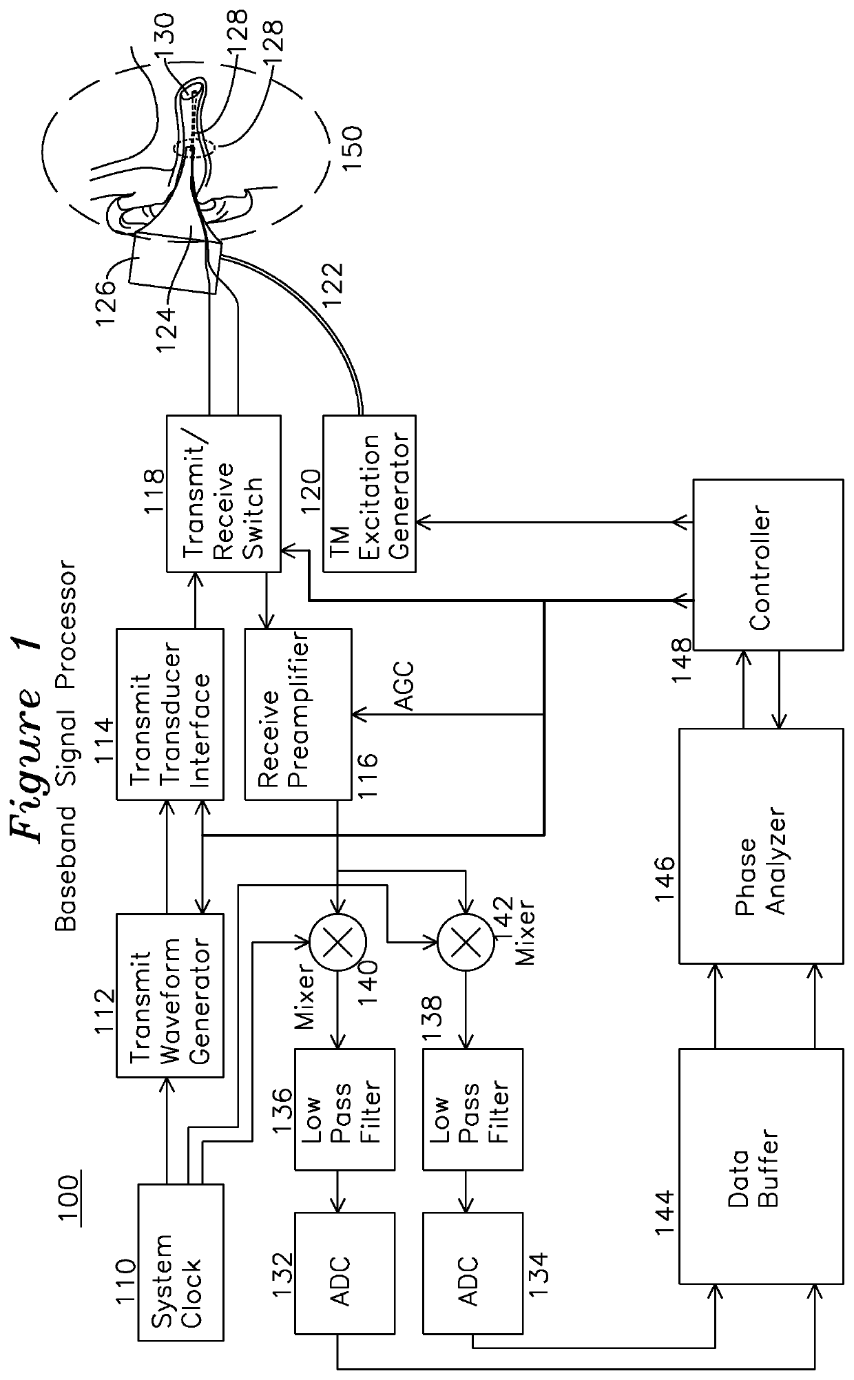 Apparatus and method for characterization of acute otitis media