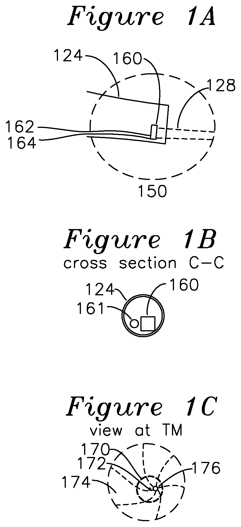 Apparatus and method for characterization of acute otitis media