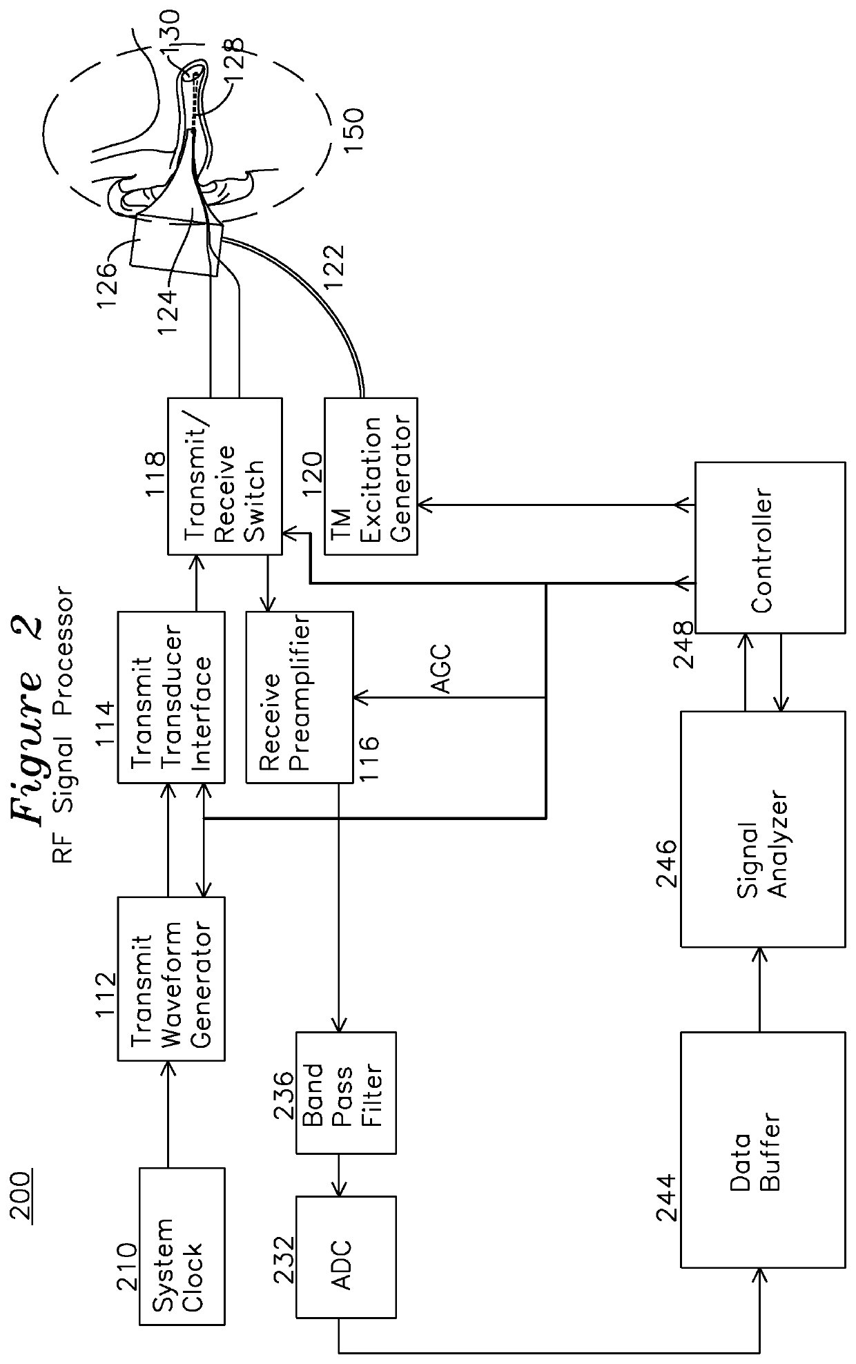 Apparatus and method for characterization of acute otitis media