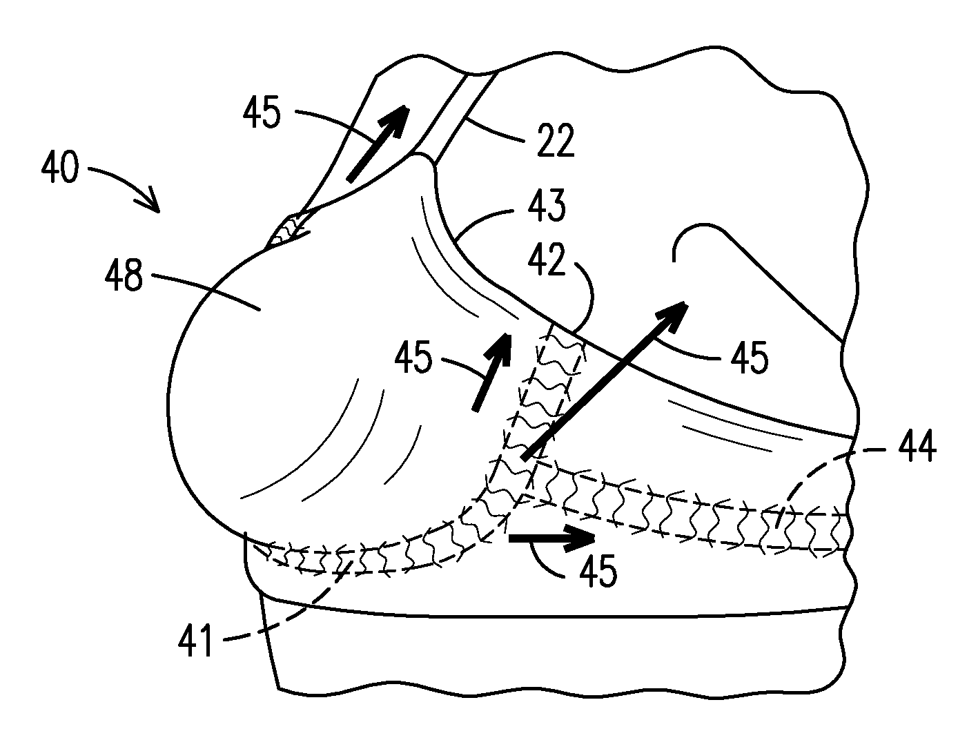 Breast shaping and lifting support garment