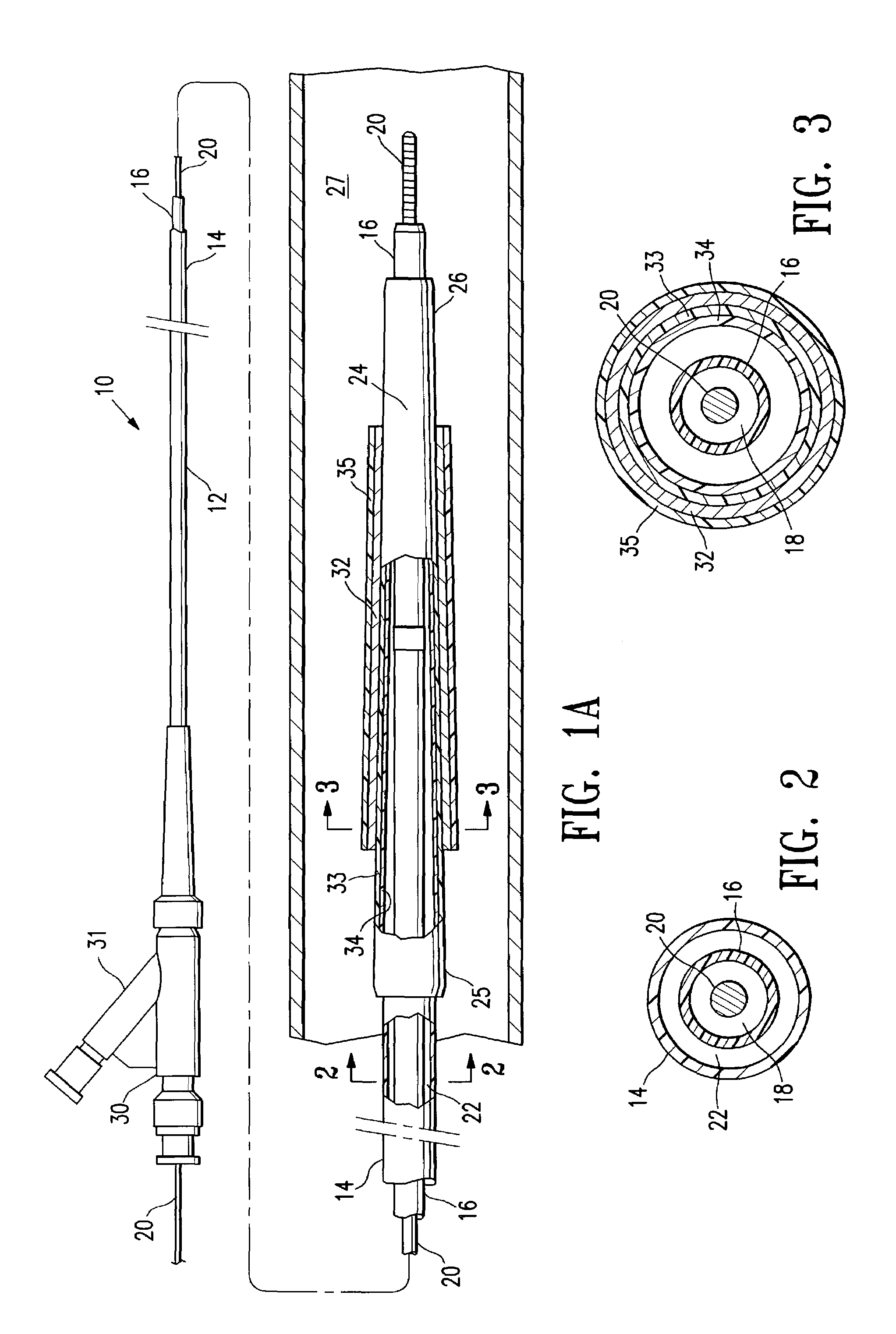 Catheter balloon