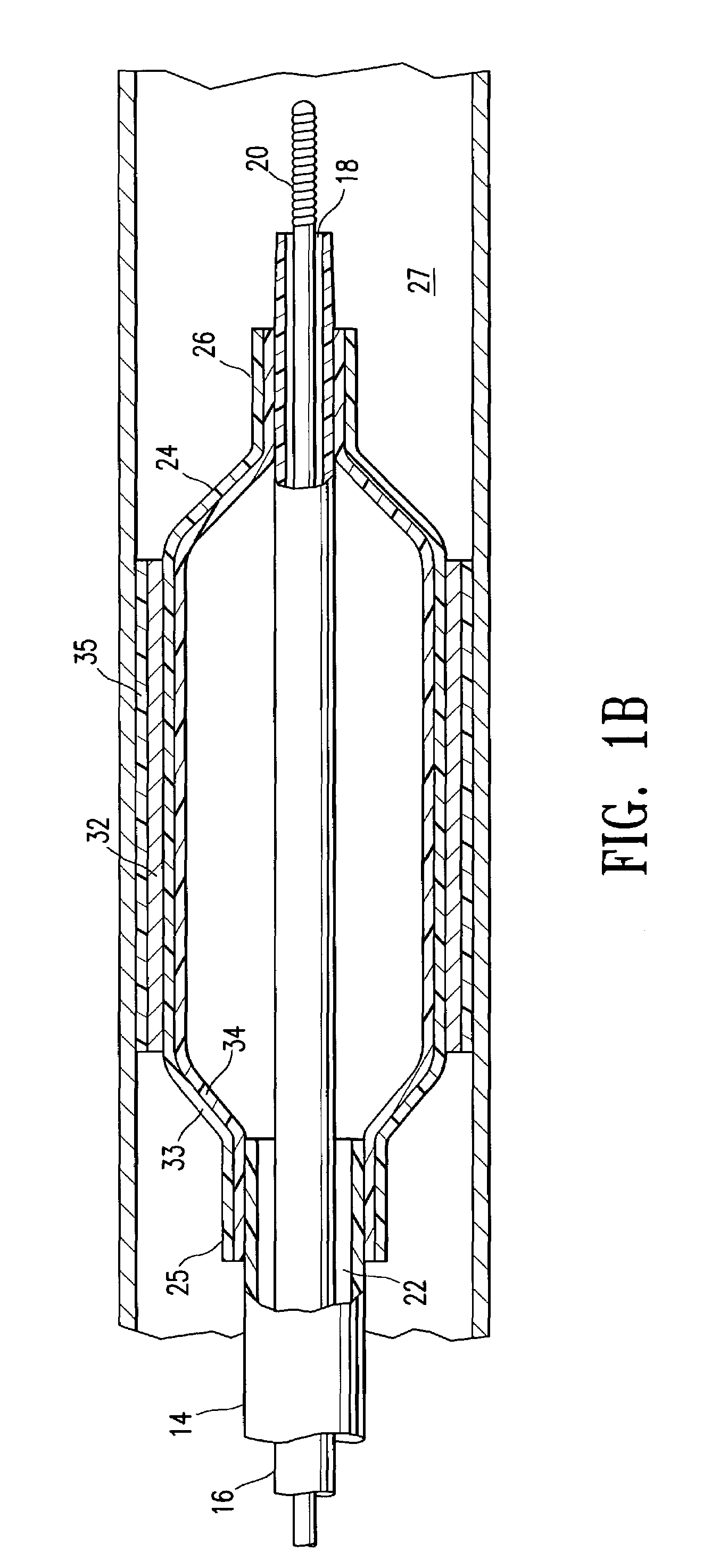 Catheter balloon