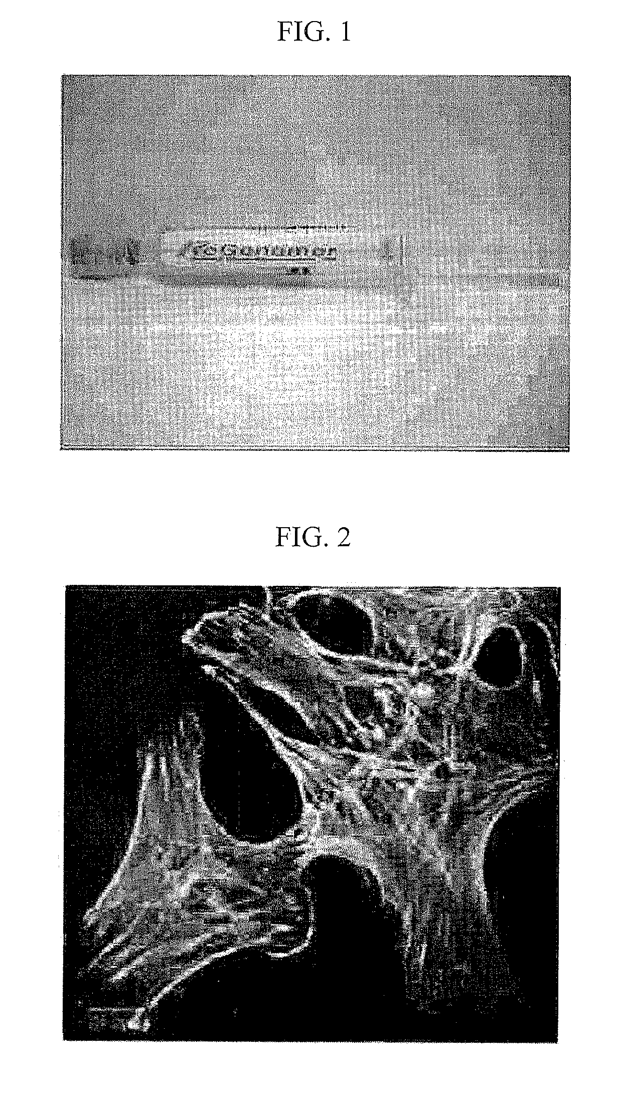 Injectable bone regeneration gel containing bone formation enhancing peptide