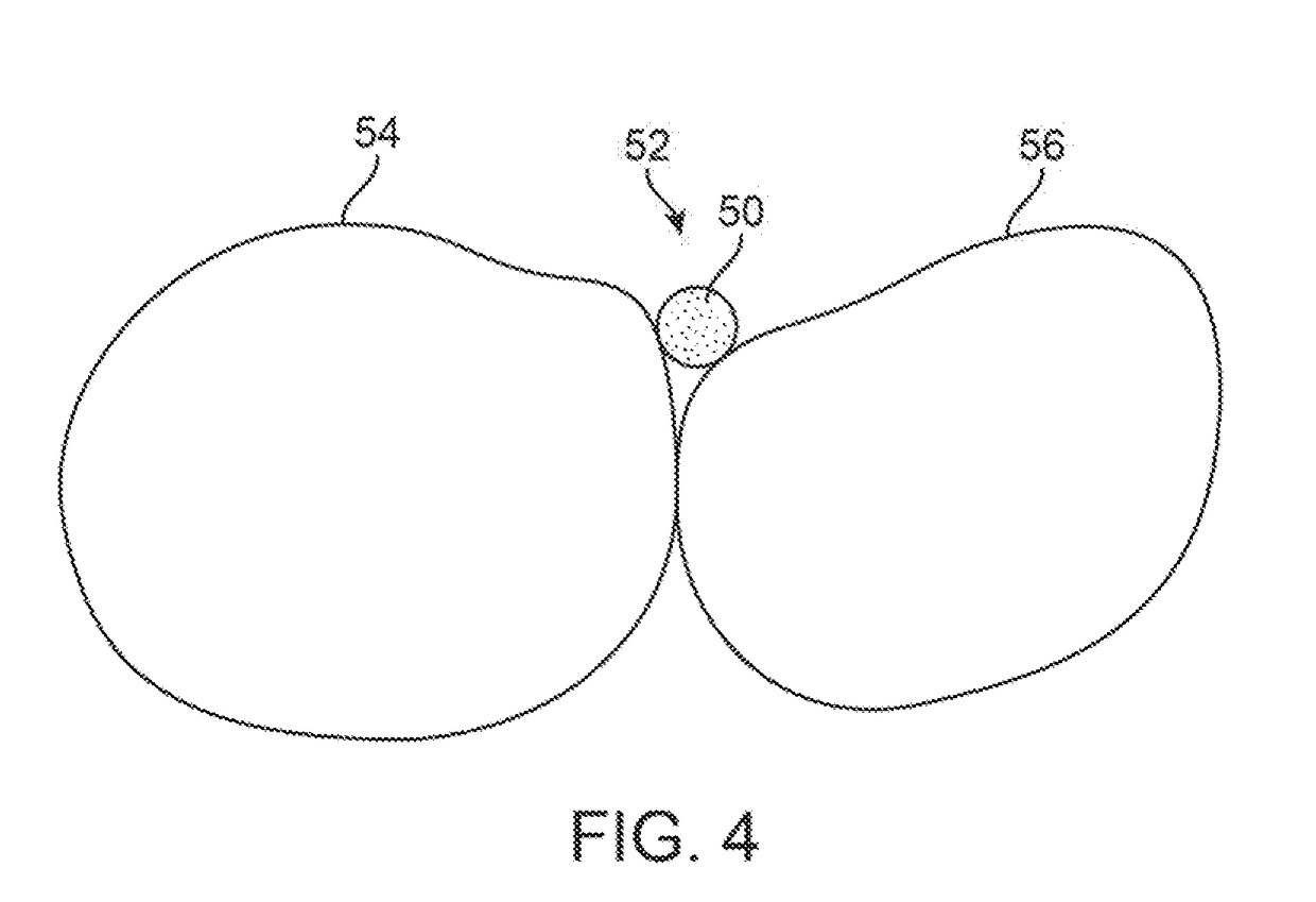 Three-dimensional printed dental appliances using support structures