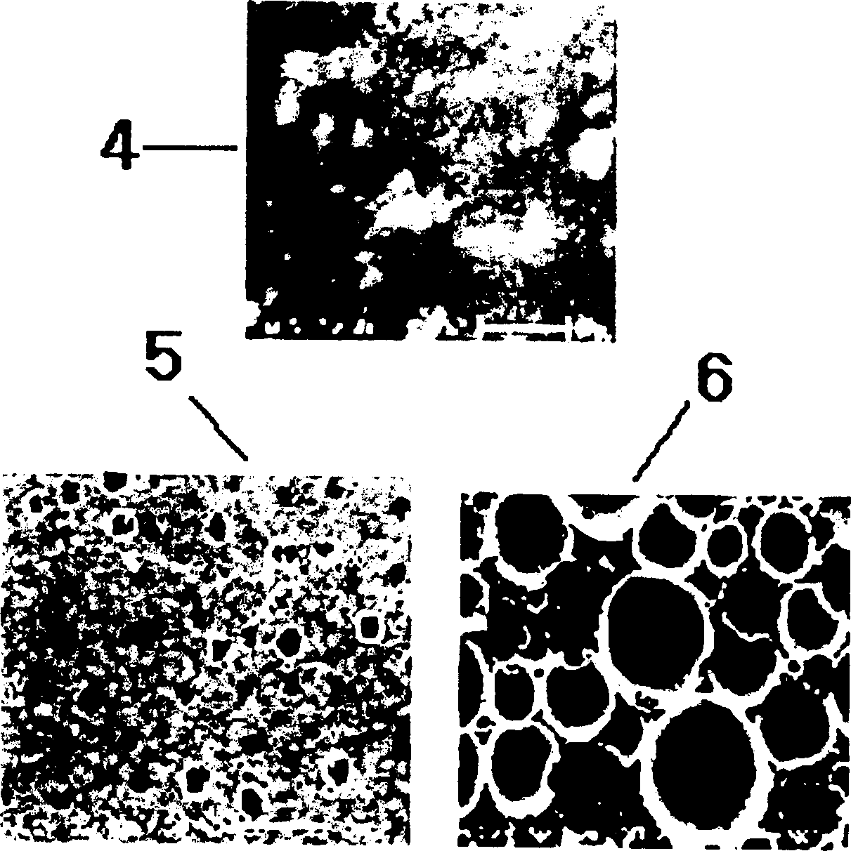 Multilayer polyporous foam dressing material and its producing method