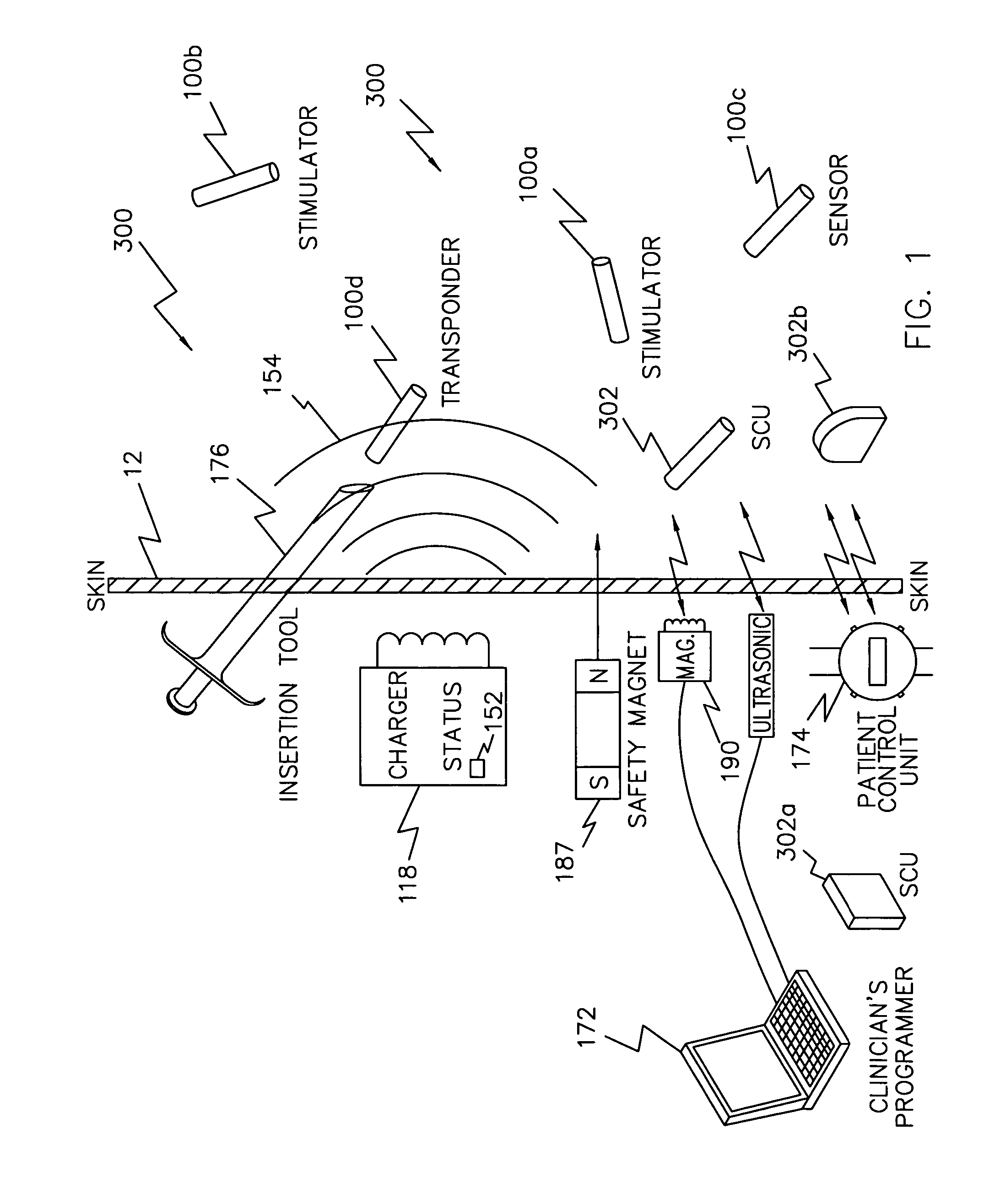 Stent having an ultrasonic emitter