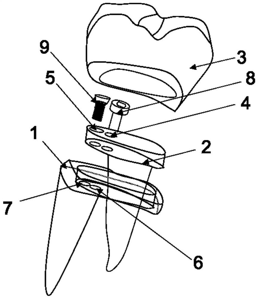 Multi-root implant tooth structure and manufacturing method thereof