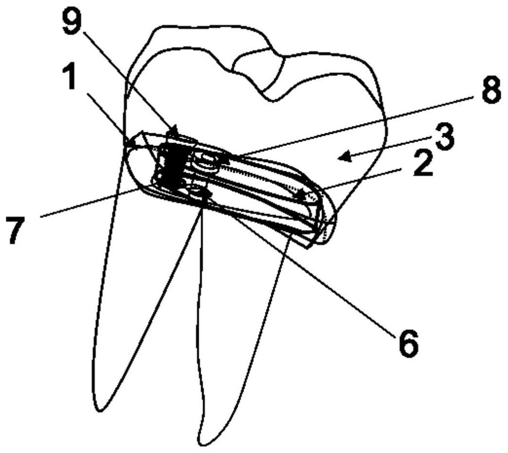 Multi-root implant tooth structure and manufacturing method thereof