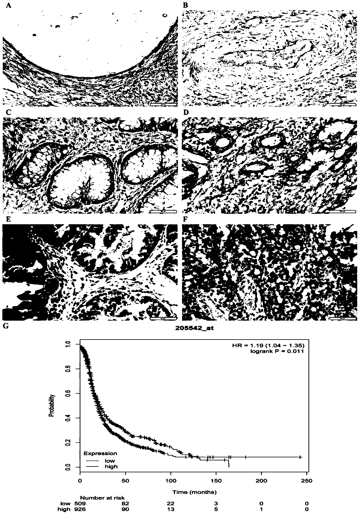 Application of STEAP1 in diagnosis, treatment and prognosis of ovarian cancer