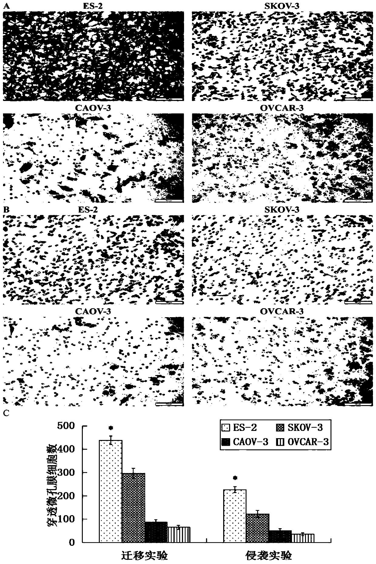 Application of STEAP1 in diagnosis, treatment and prognosis of ovarian cancer