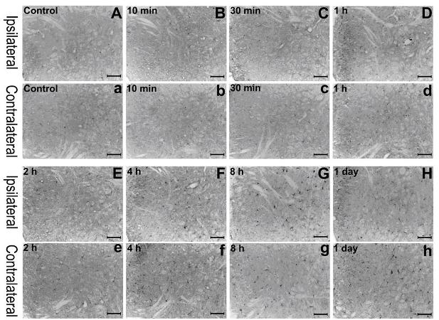 Application of inhibitor SB (Sodium Butyrate) 203580 of p (phosphor) -p38