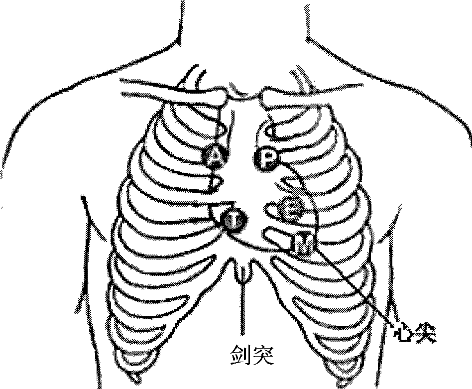 Cardiac function detecting system based on cardiac sound and electrocardiogram