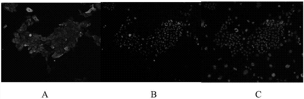 Kit for obtaining lung stem cells through separation and method