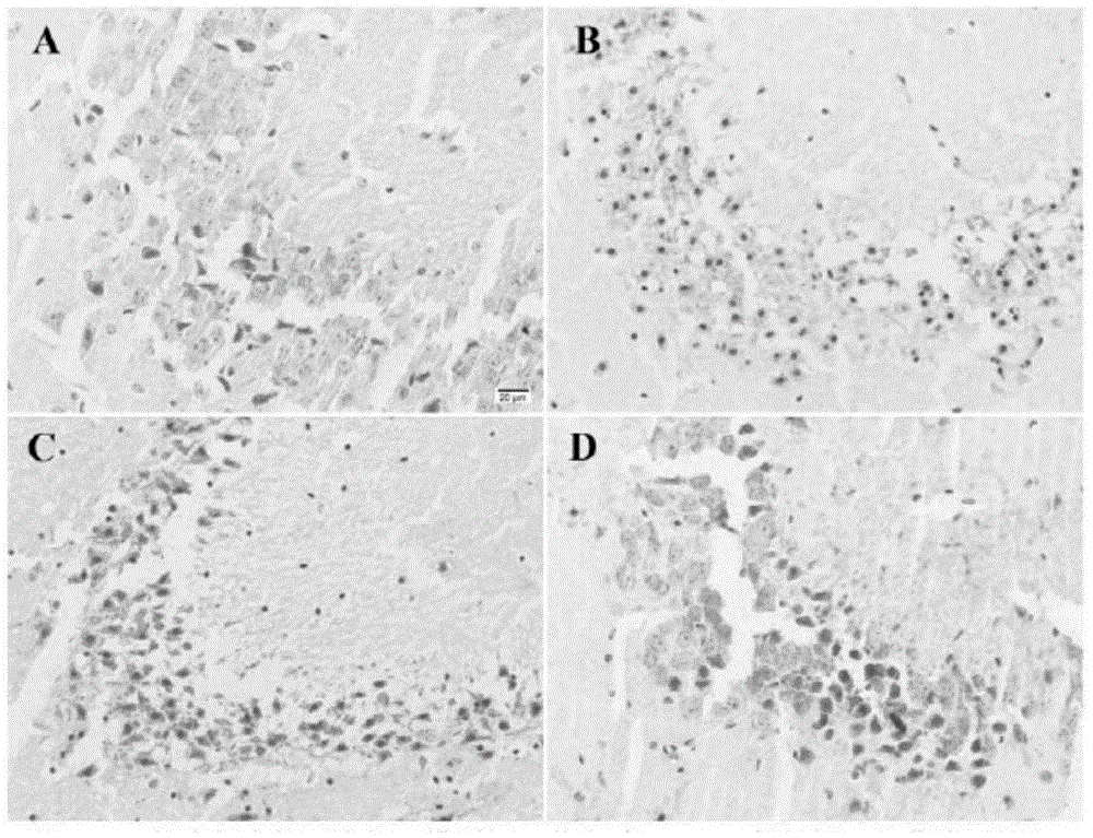 Application of Matrine in preparation of medicine for treating cerebral arterial thrombosis