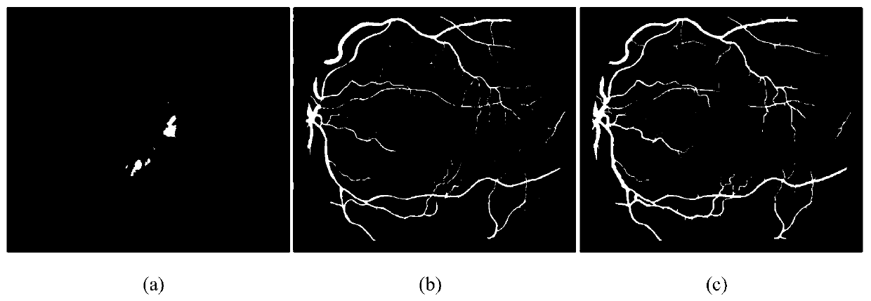 Fundus image blood vessel segmentation method