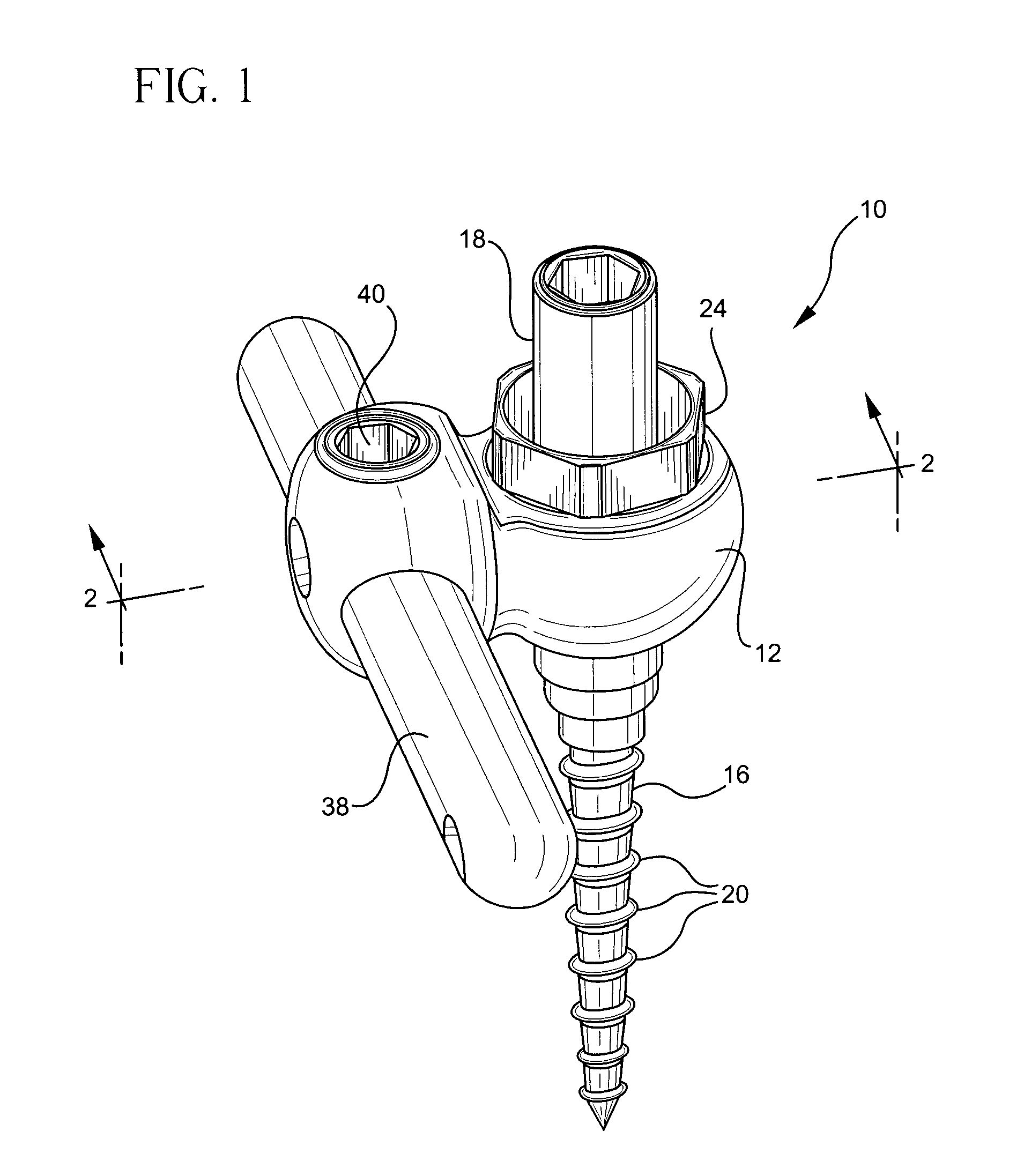 Bone fixation assembly and method