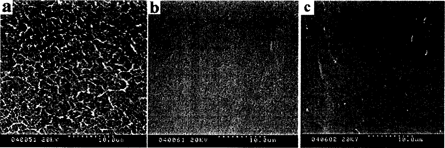 Microporous membrane and its preparing process and use thereof