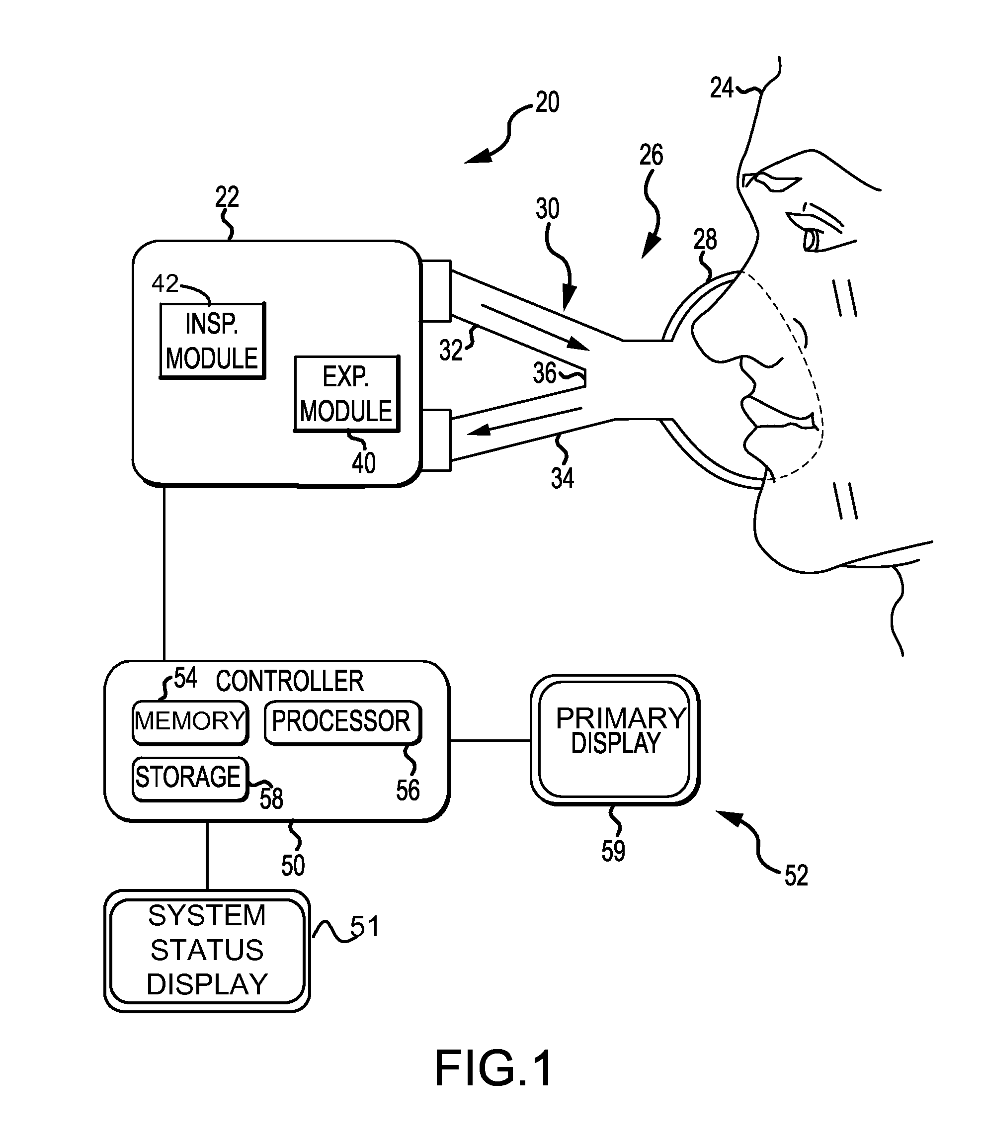 Ventilation System With Removable Primary Display