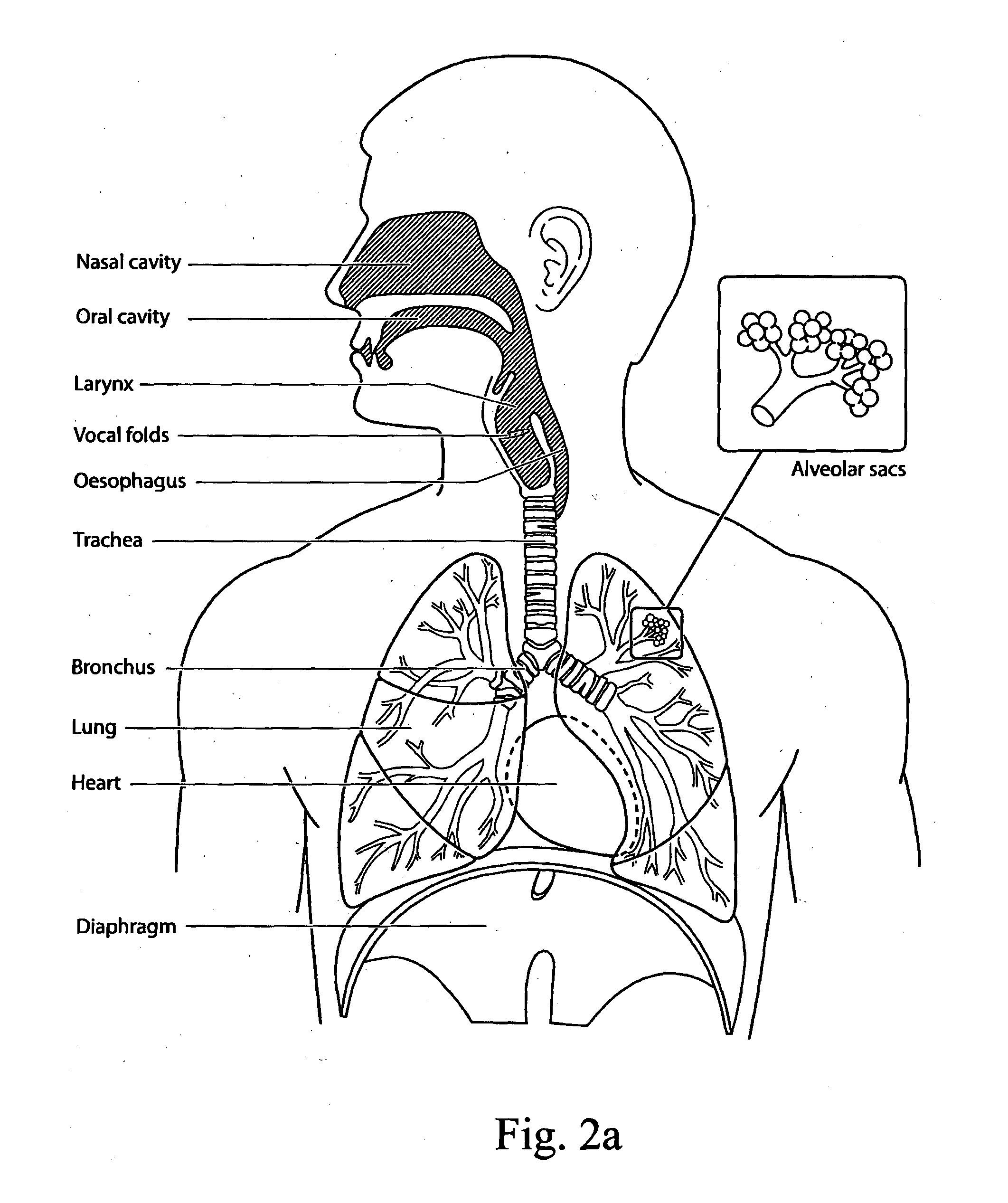 Patient interface