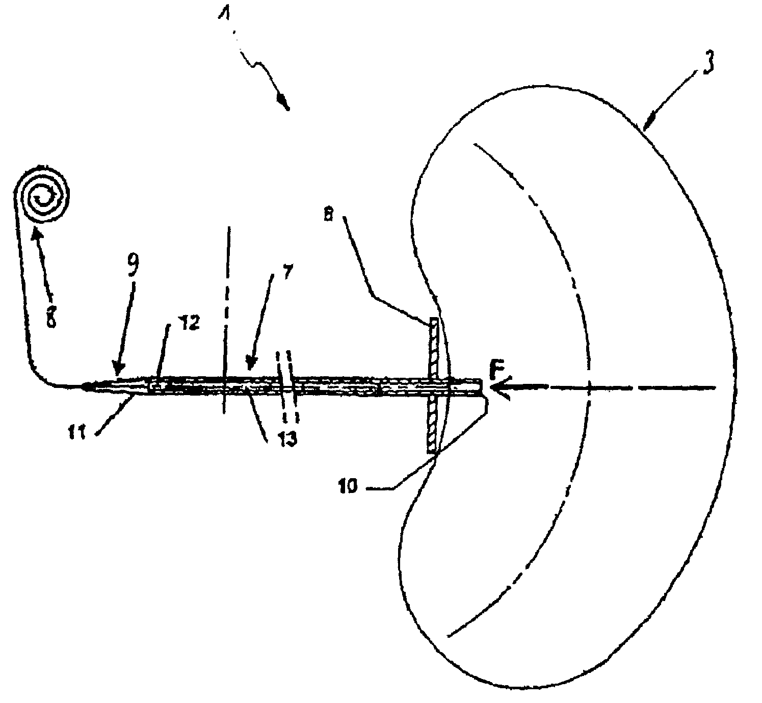 Intragastric device for treating morbid obesity