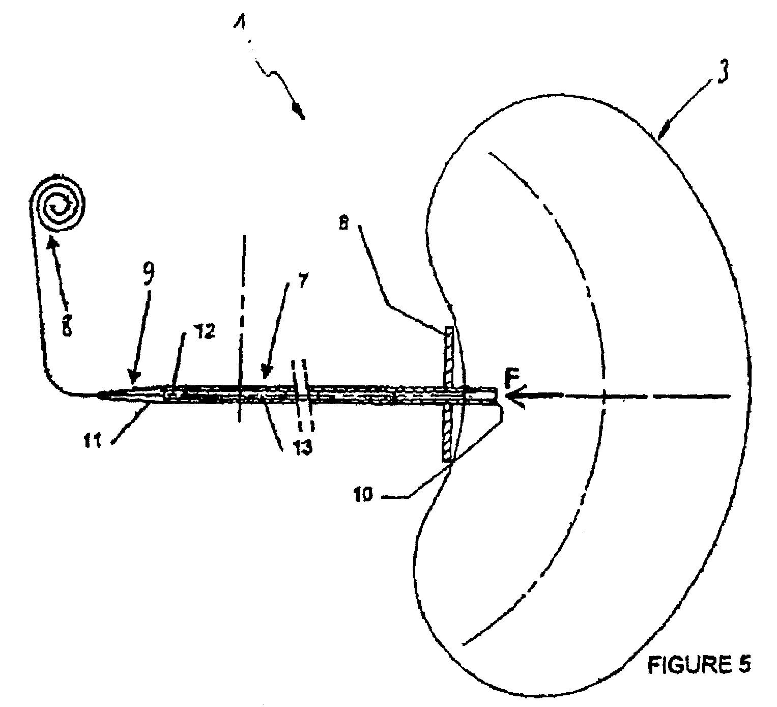 Intragastric device for treating morbid obesity