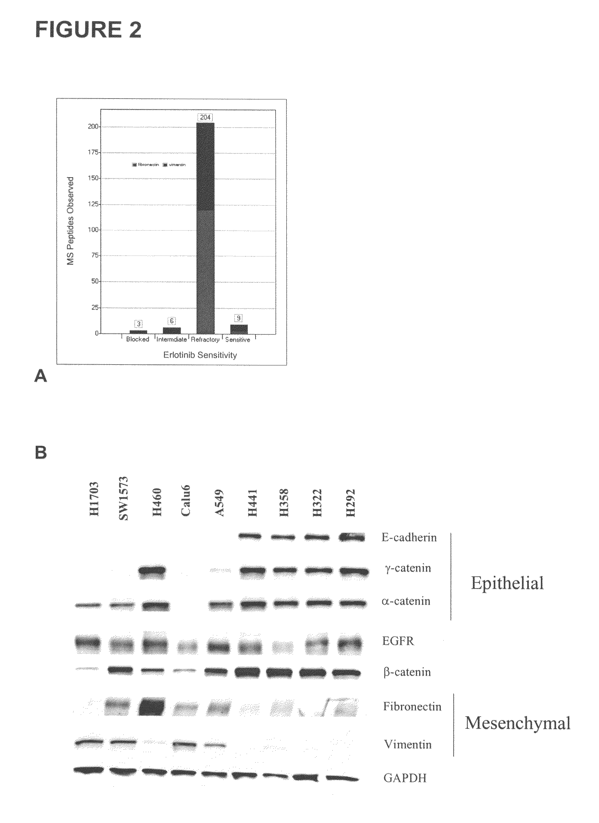 Biological markers predictive of anti-cancer response to epidermal growth factor receptor kinase inhibitors