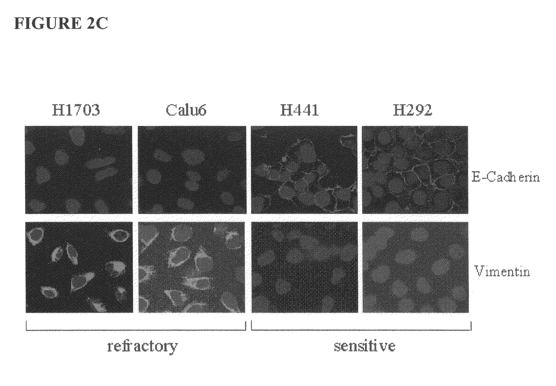 Biological markers predictive of anti-cancer response to epidermal growth factor receptor kinase inhibitors