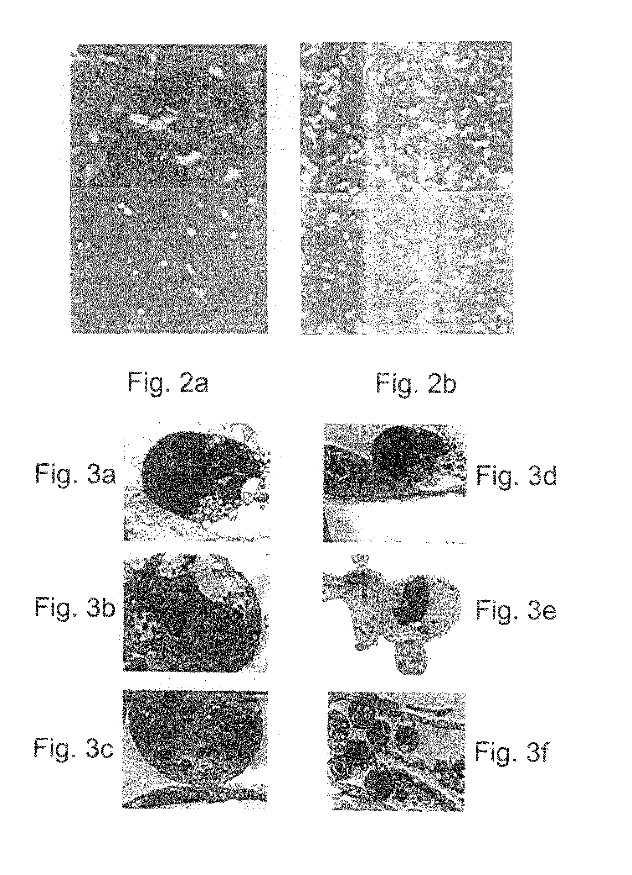 Promoters exhibiting endothelial cell specificity and methods of using same for regulation of angiogenesis