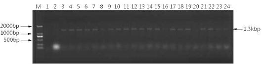 Screening method for using xylose isomerase genes for peanut genetic transformation