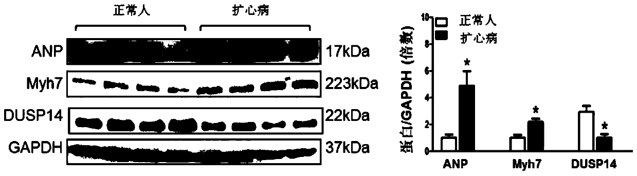 Function and application of dual specificity phosphatase 14 (dusp14) in the treatment of cardiac hypertrophy