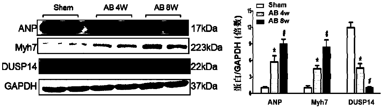 Function and application of dual specificity phosphatase 14 (dusp14) in the treatment of cardiac hypertrophy