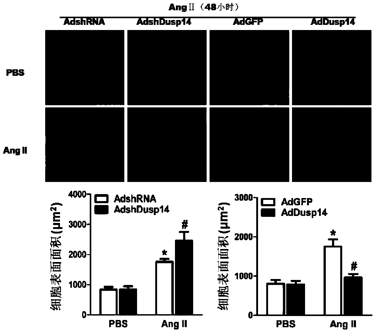 Function and application of dual specificity phosphatase 14 (dusp14) in the treatment of cardiac hypertrophy