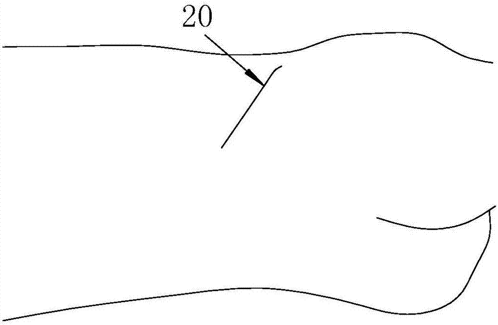 Transforaminal endoscope operation positioning method based on X-ray machine